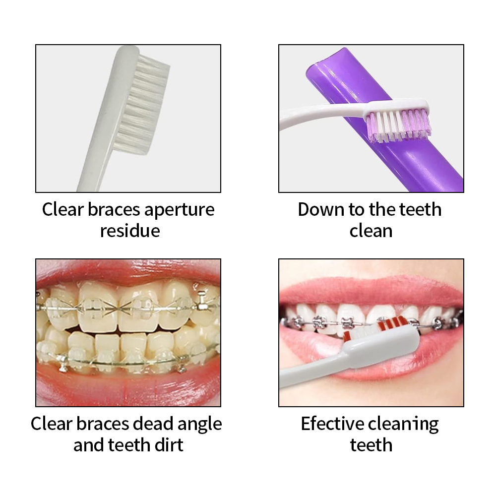 8Pcs/set Orthodontic Dental Ca - Teeth Whitening With Braces ulasan dan harga
