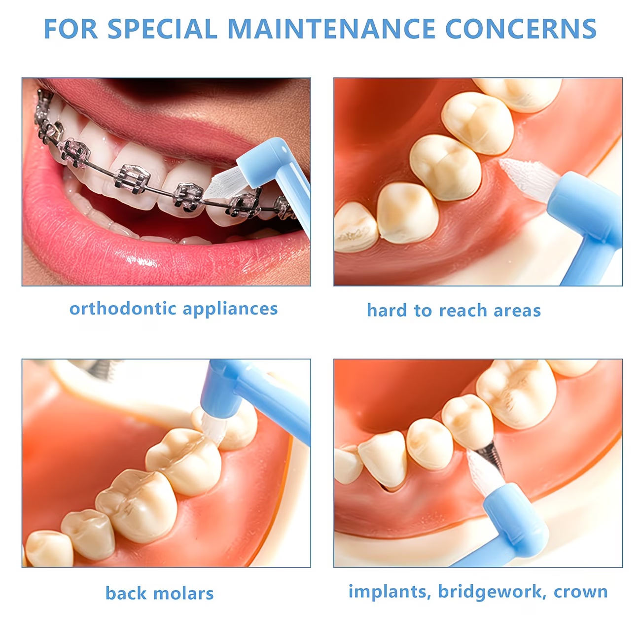 1/3pc Orthodontic Braces Tooth - Teeth Whitening With Braces ulasan dan harga