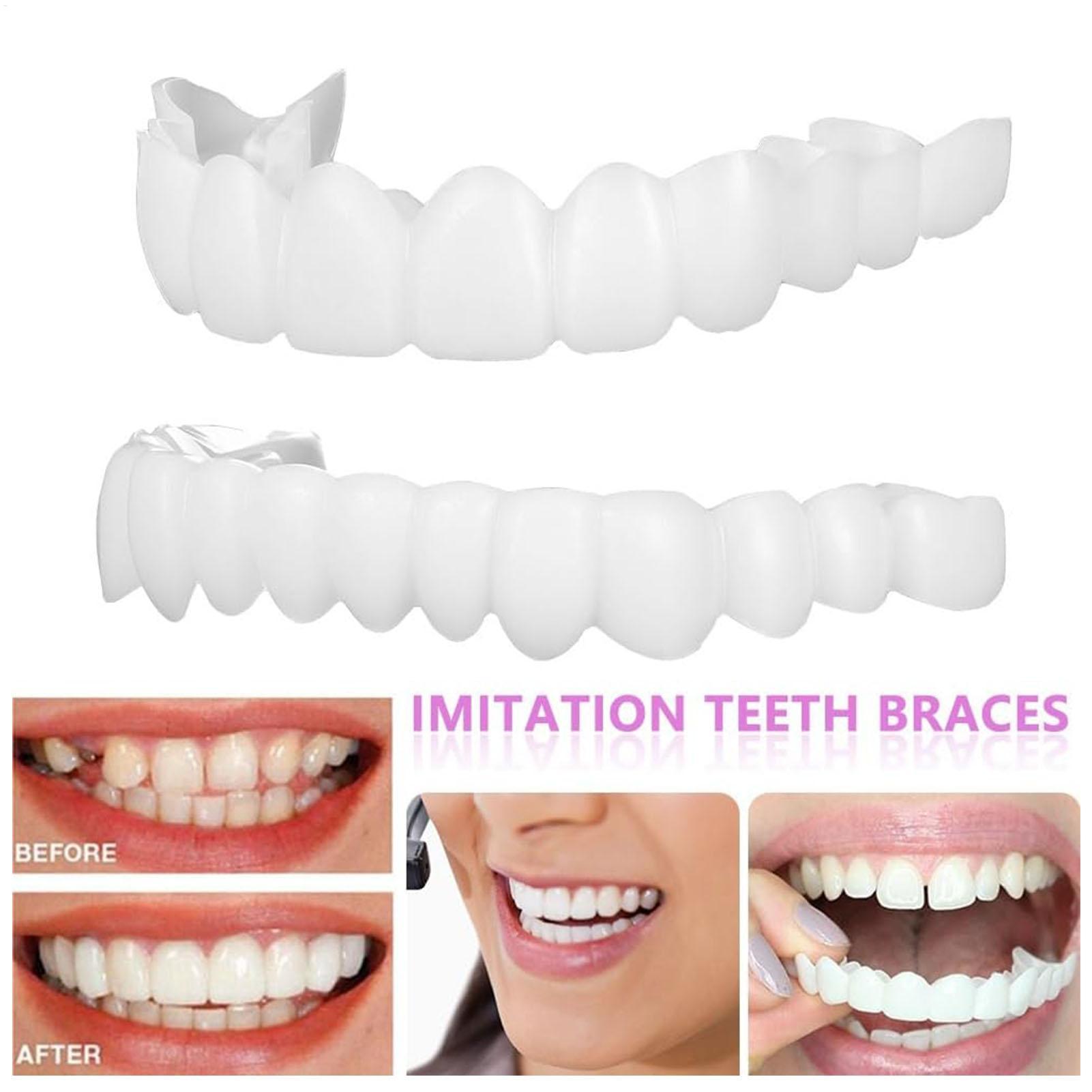 Dental Upper Lower Fake Teeth  - Teeth Whitening With Braces ulasan dan harga