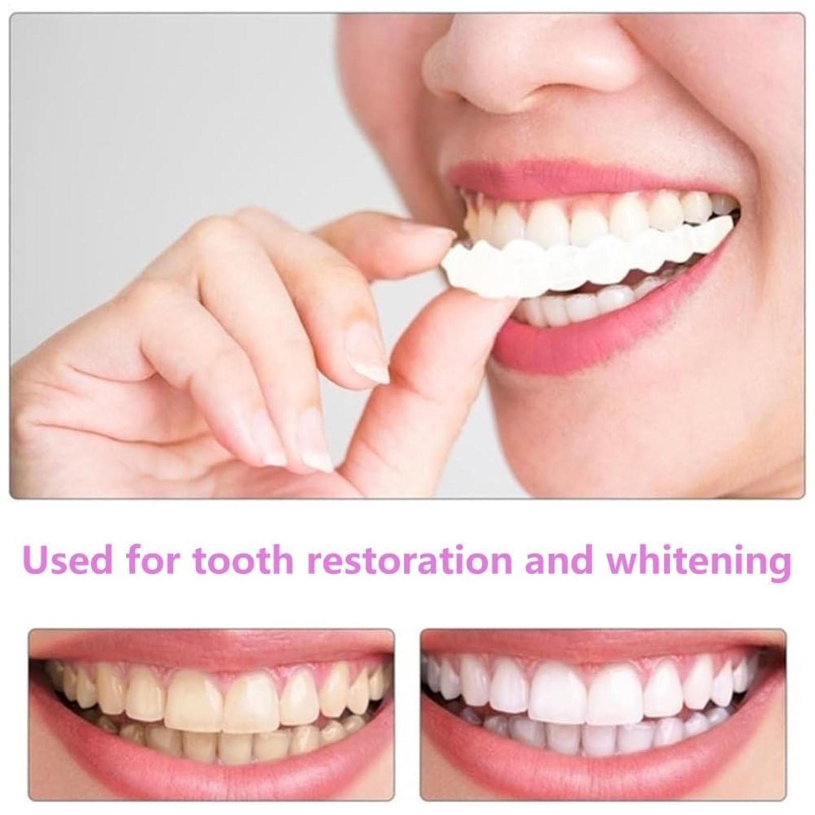 Dental Upper Lower Fake Teeth  - Teeth Whitening With Braces ulasan dan harga