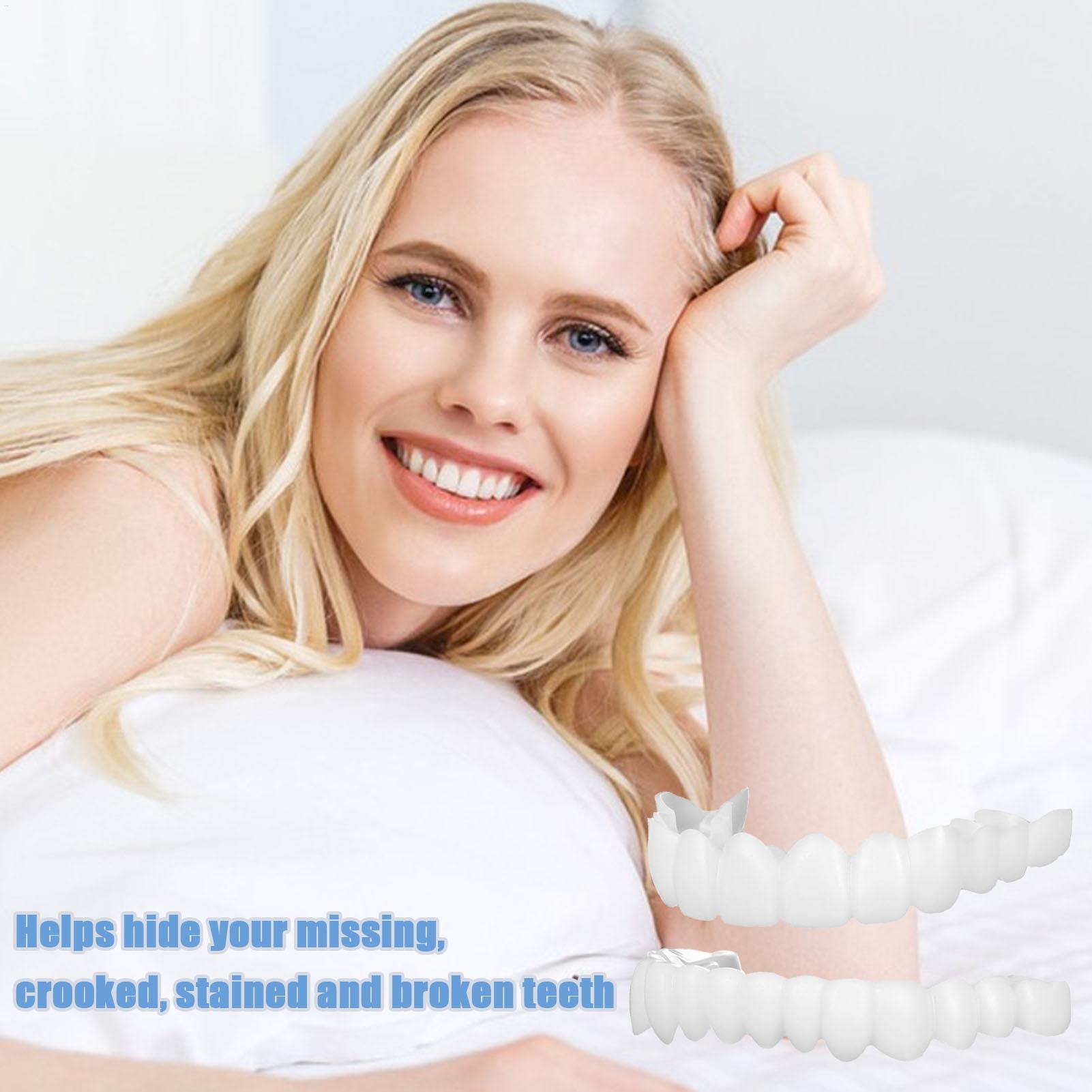 Dental Upper Lower Fake Teeth  - Teeth Whitening With Braces ulasan dan harga