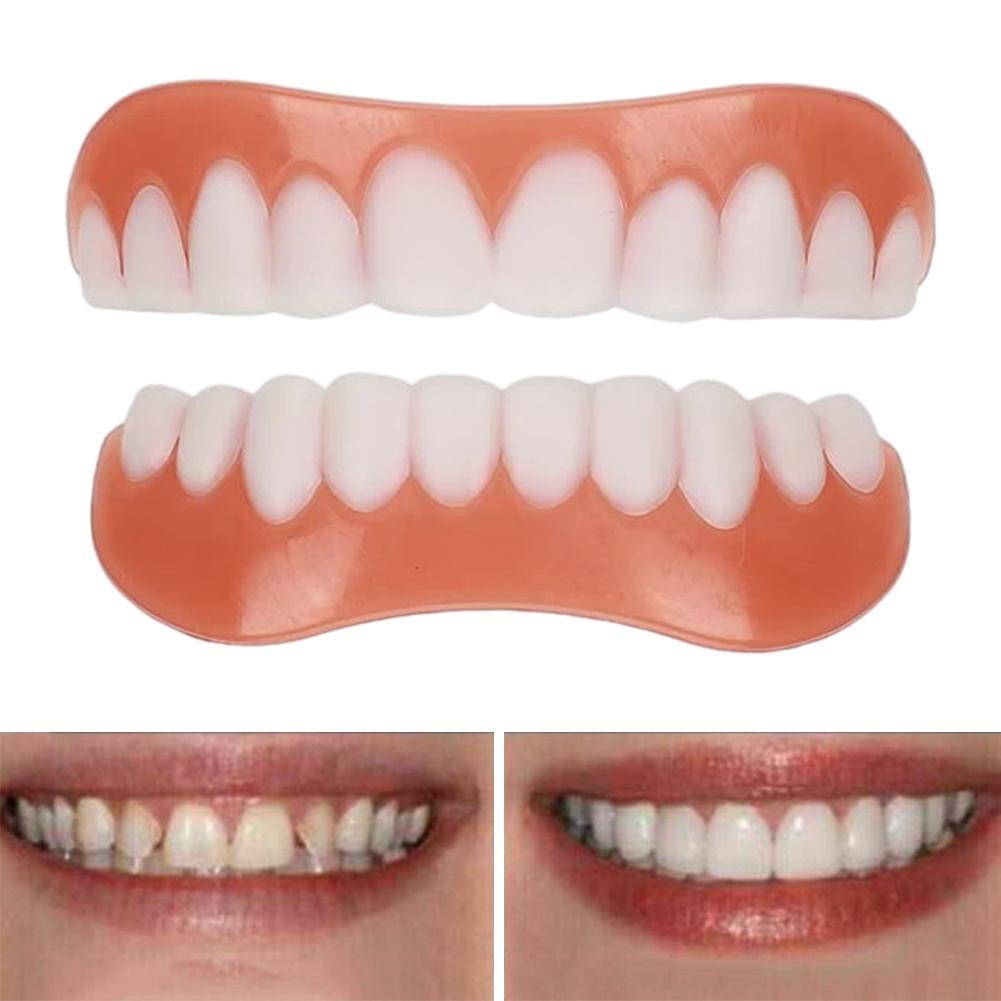 New False Teeth Silicone Upper - Teeth Whitening With Braces ulasan dan harga