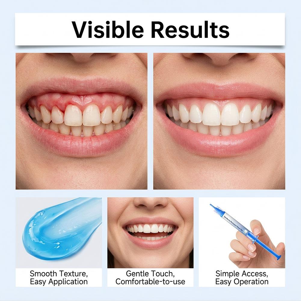 Gum Periodontal Repair Gel Syr - Teeth Whitening Gel Syringes ulasan dan harga