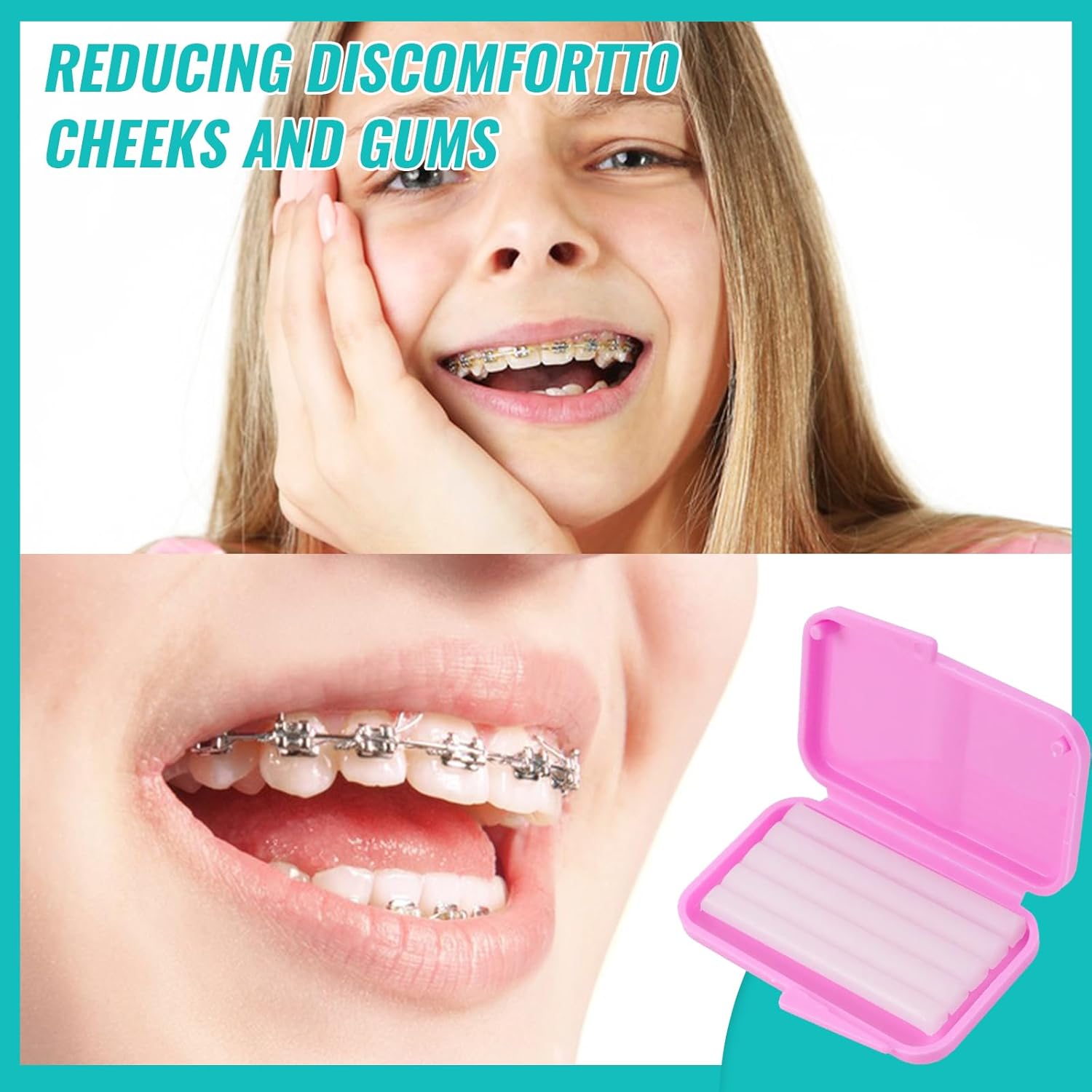10box Dental Orthodontic Relie - Teeth Whitening With Braces ulasan dan harga