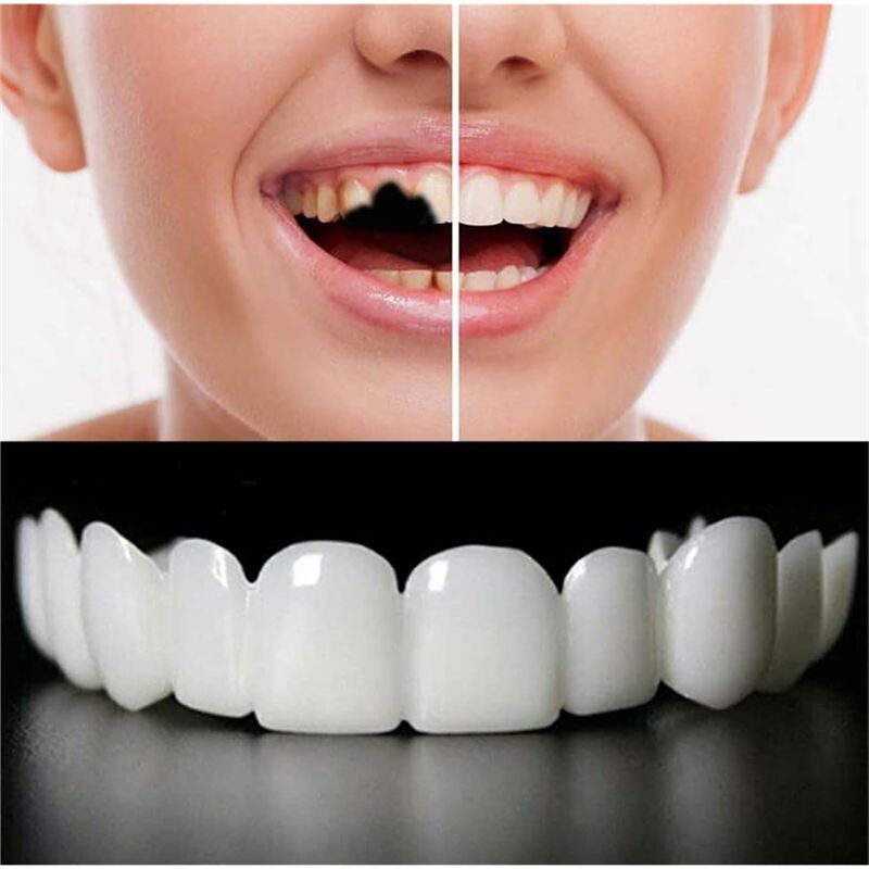 [NEW!ABMK】 2 Pairs,Regain Beau - Teeth Whitening With Braces ulasan dan harga